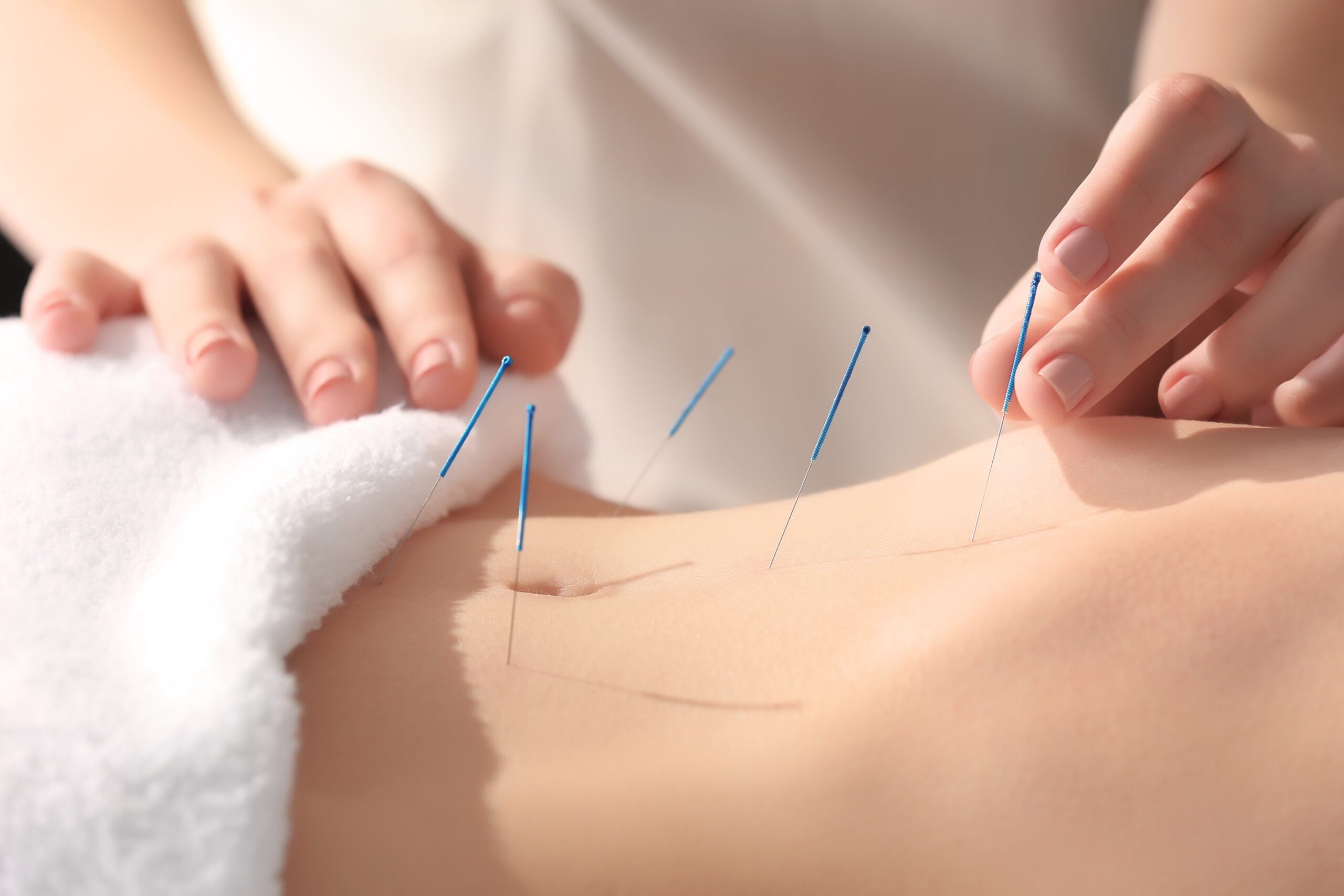 Piercing Pain And Restoring Harmony: The Technique Used In Acupuncture